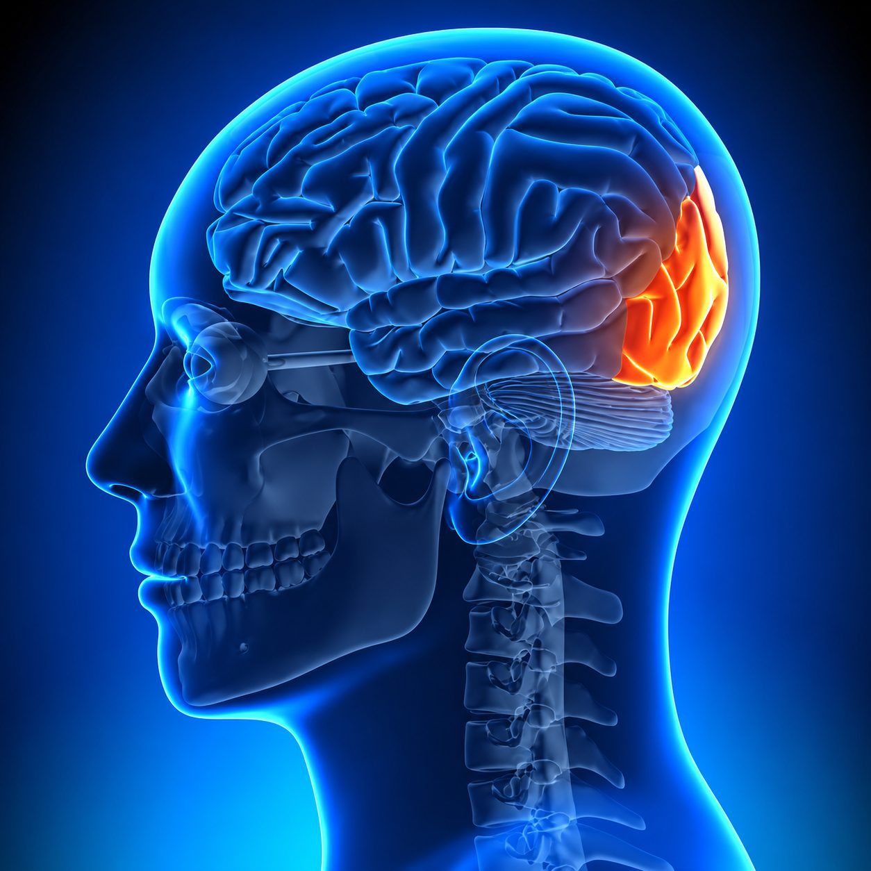 Cranial Nerve 2 Sclerosis Illustration - Cranial Nerve